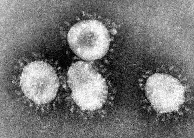 COVID-19 is a respiratory illness that can spread from person to person. (WYDaily/Courtesy of Wikimedia Commons)(WYDaily/Courtesy of Wikimedia Commons)